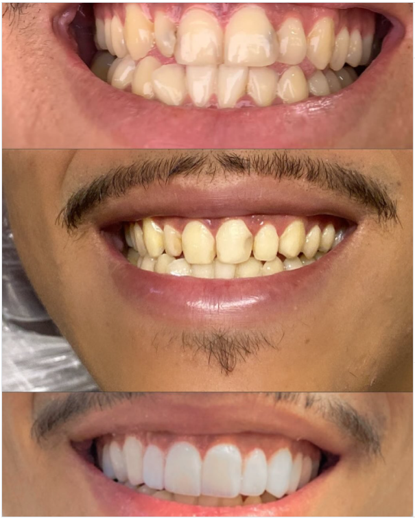 Atendimento clínico geral no Espaço Odonto